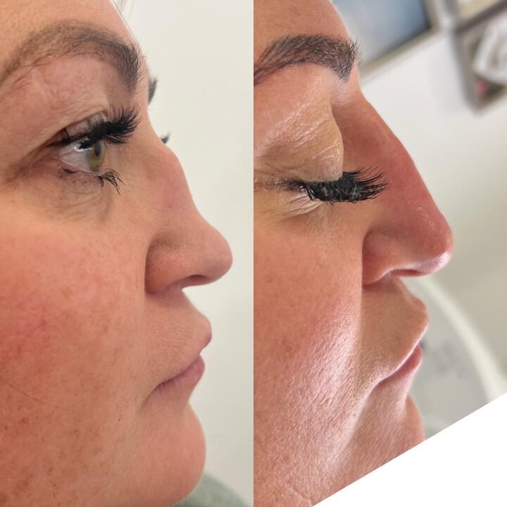 Kayleigh jones aesthetics and laser specialist image 2