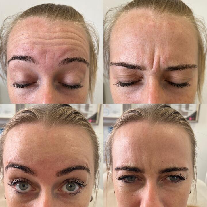 Kayleigh jones aesthetics and laser specialist image 1