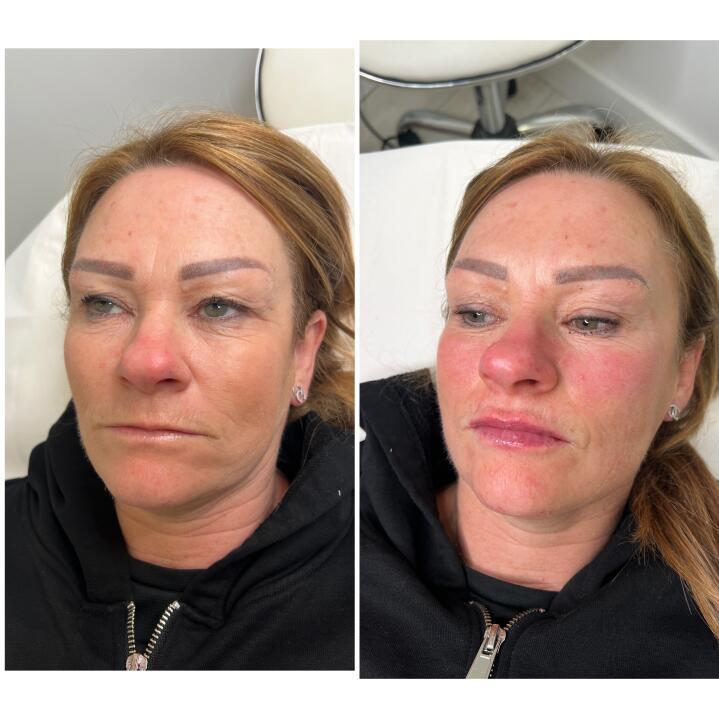 Kayleigh jones aesthetics and laser specialist image 3