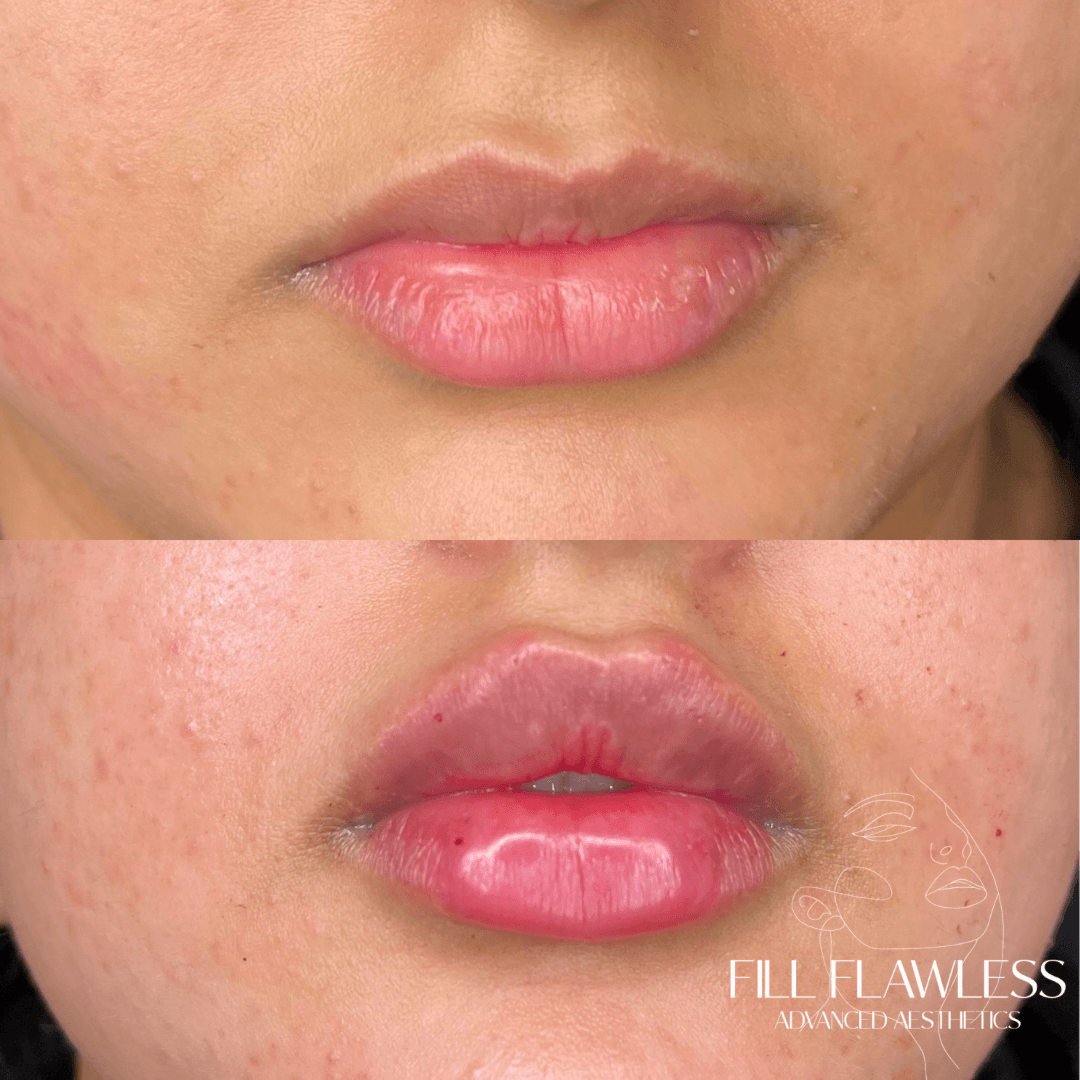 Fill Flawless image 3