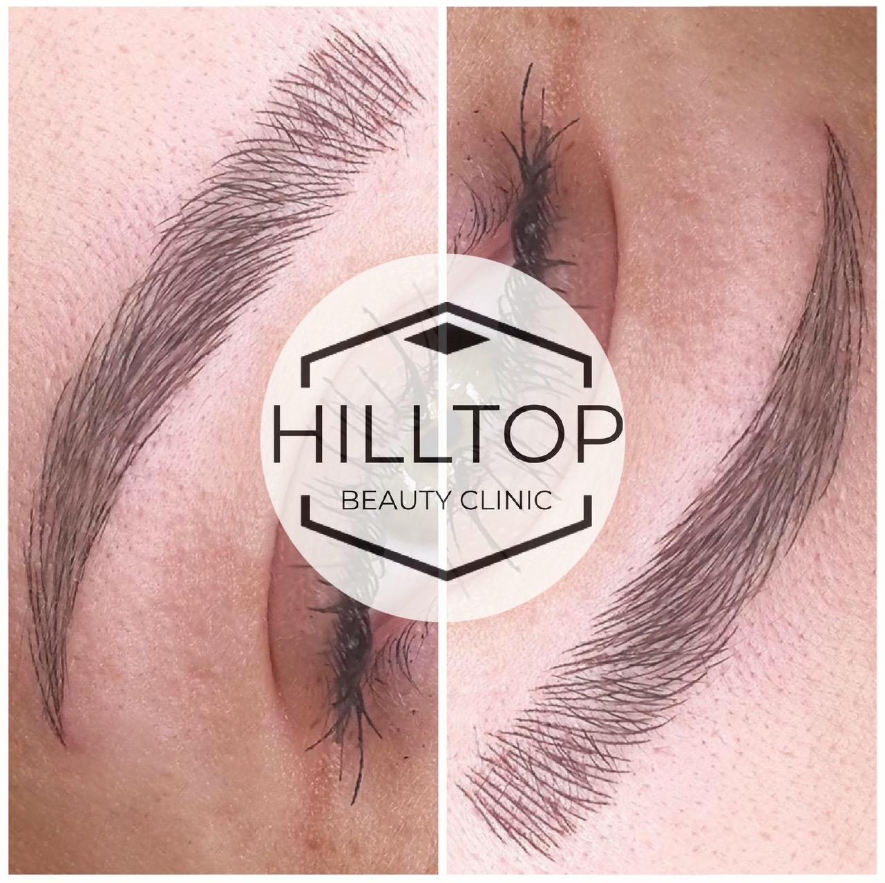 Hilltop Beauty Clinic image 3