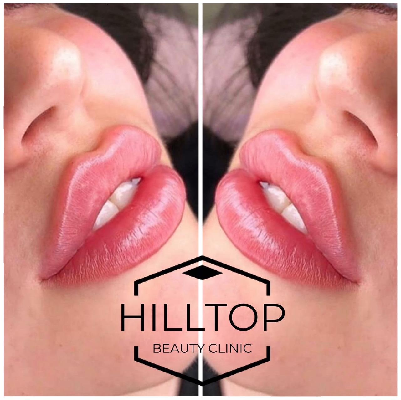 Hilltop Beauty Clinic image 1