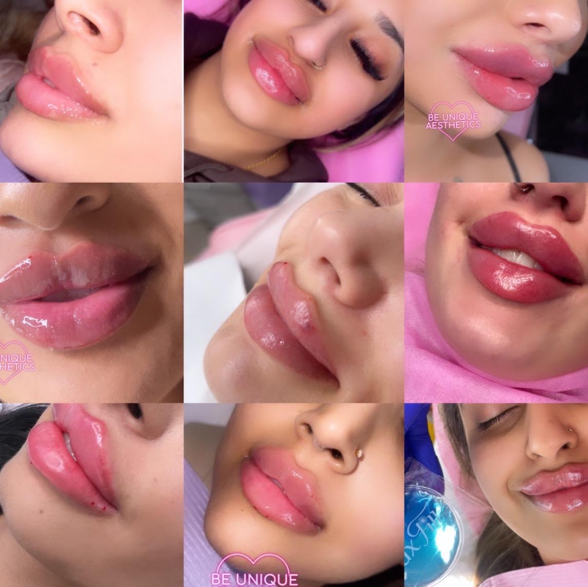 Be Unique Aesthetics Aisha Zaman image 1