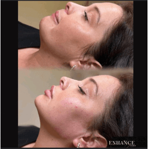 Enhance beauty essex image 3