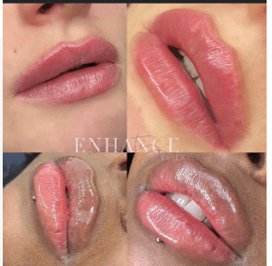 Enhance beauty essex image 2