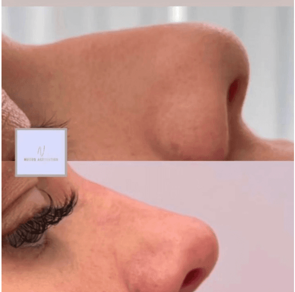 Nudus Aesthetics image 3