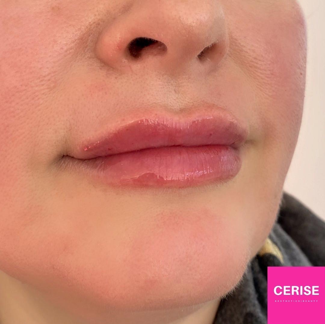 Cerise Aesthetics and Beauty Ltd image 3