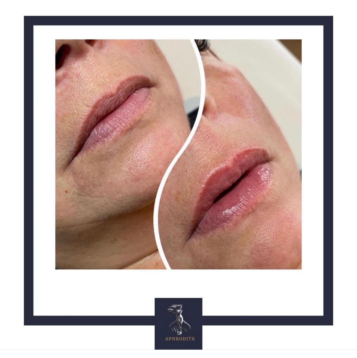 Aphrodite Aesthetics & Skin Clinic image 2