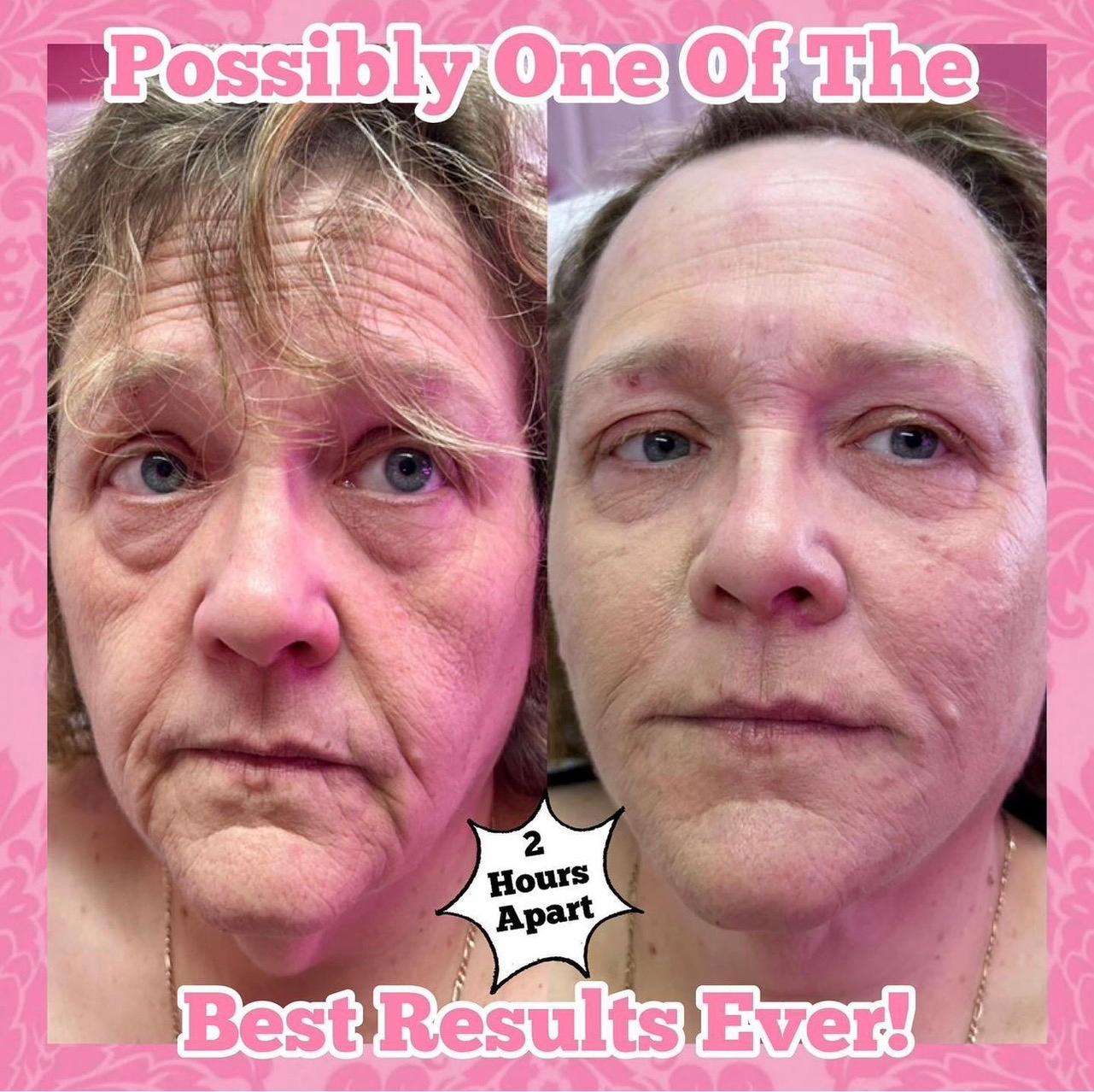 The Flawless  Guru Aesthetics Clinic image 2