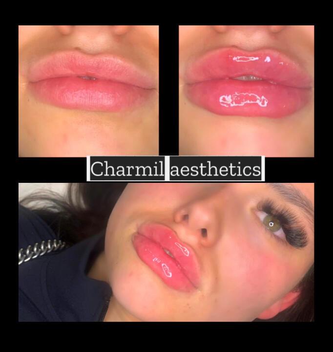 Charmil aesthetics image 2