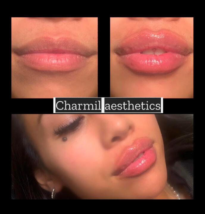Charmil aesthetics image 3