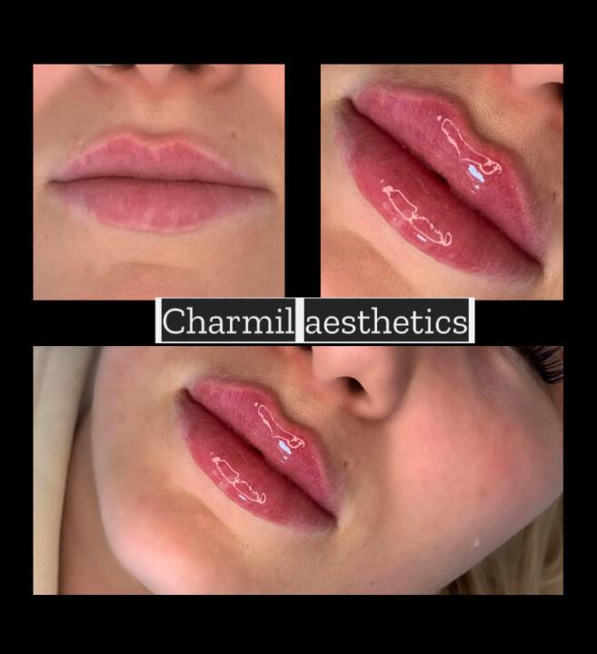 Charmil aesthetics image 1