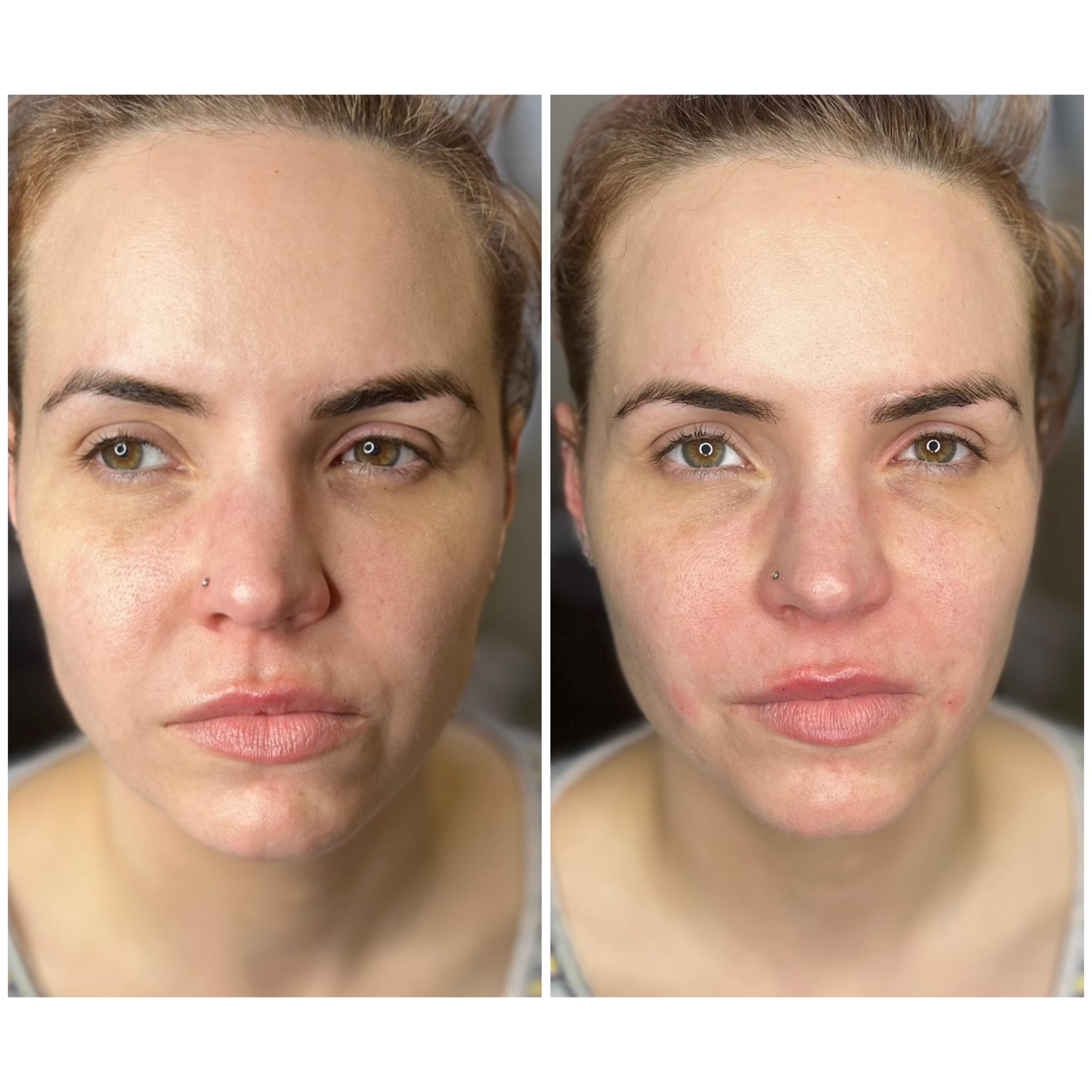 Emma Rogers Aesthetics image 1