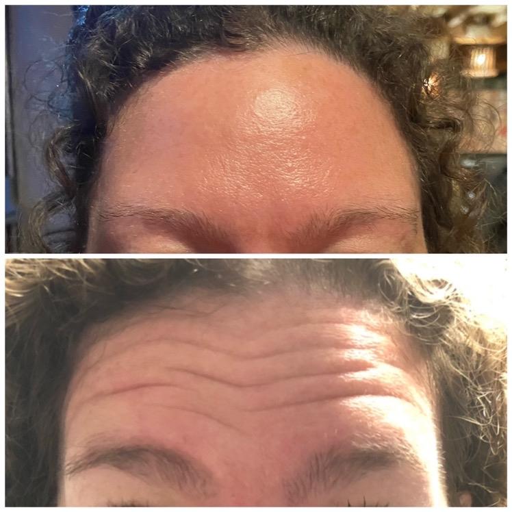 Lisa Ramshaw Beauty & Aesthetics Clinic image 2