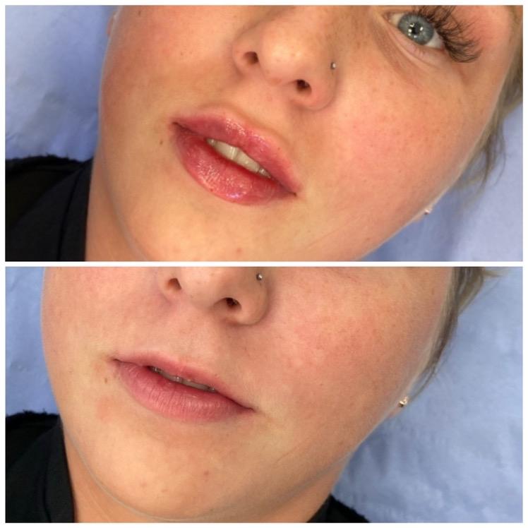 Lisa Ramshaw Beauty & Aesthetics Clinic image 3