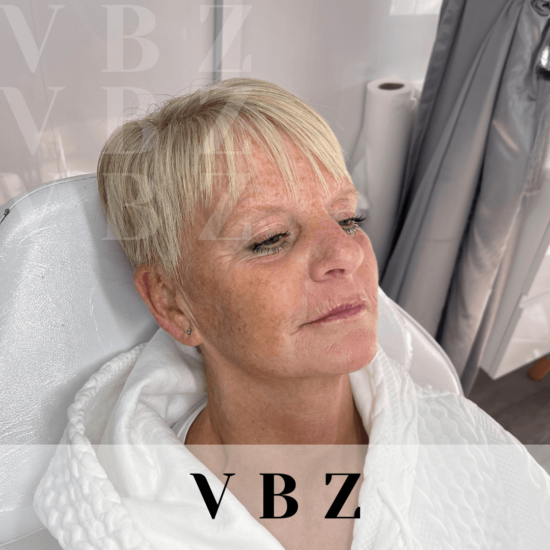VBZ Aesthetics image 2