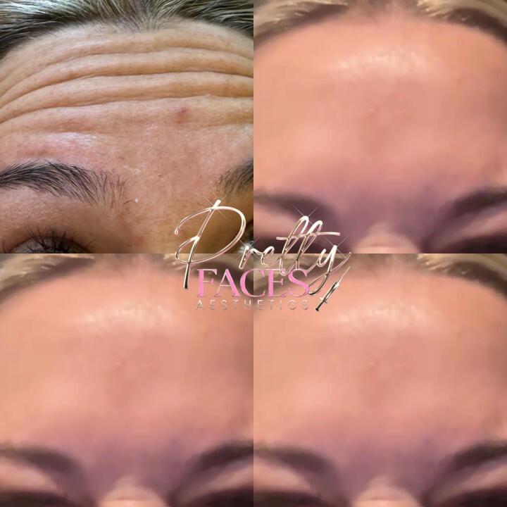 Pretty Faces Aesthetics image 1