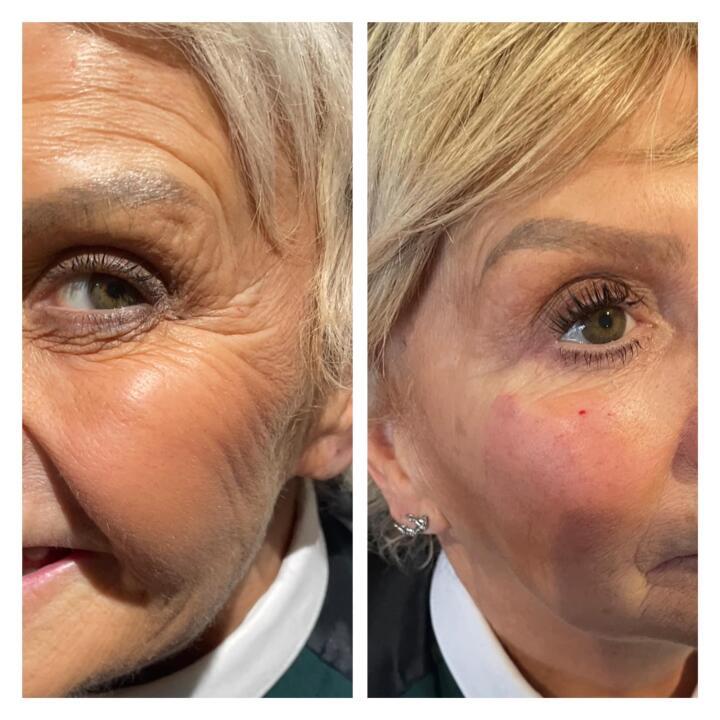 Eternal facial aesthetics image 1