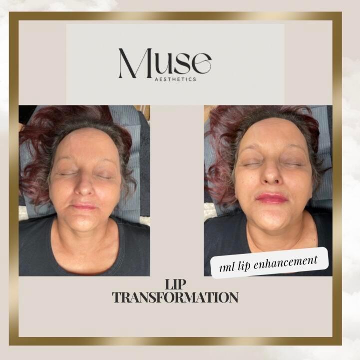 Muse aesthetics image 3