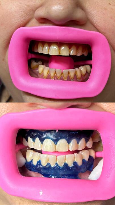 Smiley Whites image 2