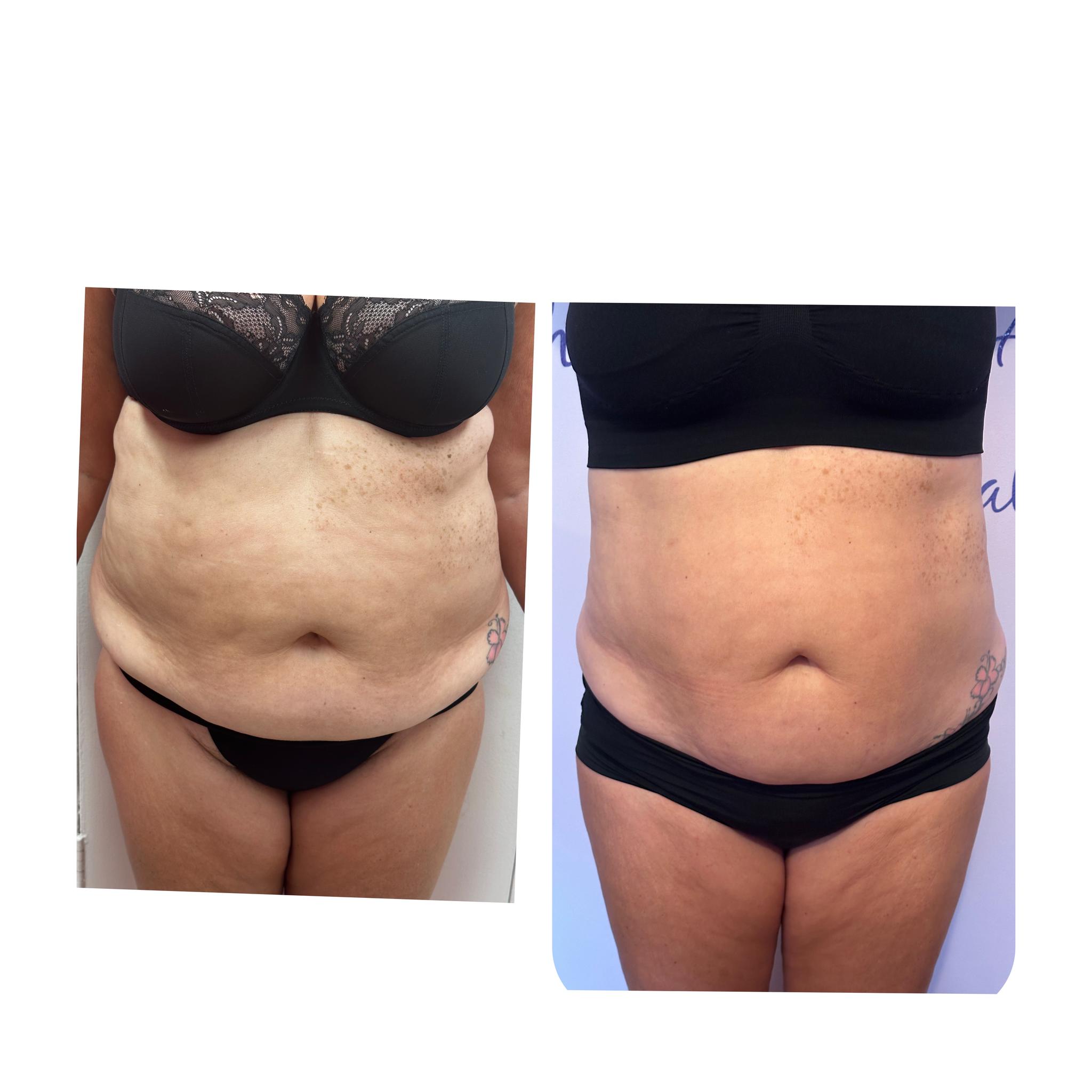 Healthy4Life Aesthetics Clinic image 2