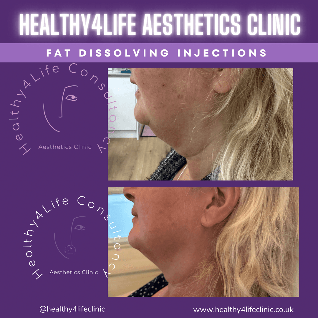 Healthy4Life Aesthetics Clinic image 3
